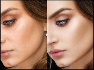 Retouching Labs